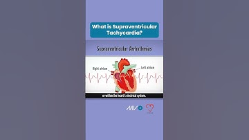 What is Supraventricular Tachycardia?