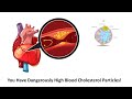 You Have Dangerously High Blood Cholesterol Particles: A Discussion On LDL And HDL