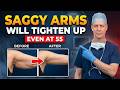 Your Arms Aren’t Fat — You’re Missing THIS One Thing