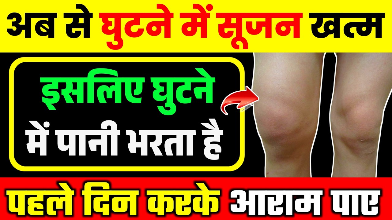 घुटने में सूजन और पानी भरने का इलाज|Knee Effusion Exercises In Hindi|Knee Strengthening Exercises