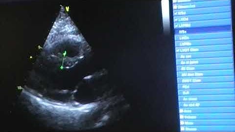 Complete echo protocol