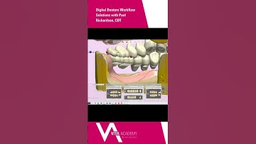 Digital Denture Workflow Solutions with Paul Richarson, CDT