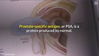 What is Prostate Specific Antigen (PSA)