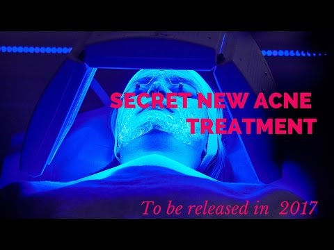 Latest acne treatment- due in 