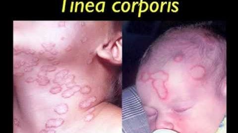 Mycology Specimen Collection Part 1