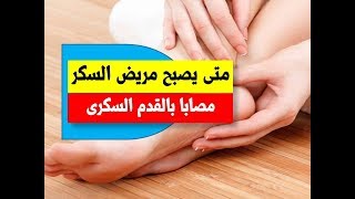 متى يصبح مريض السكر مصاب بالقدم السكرى | اعراض و علامات القدم السكرى