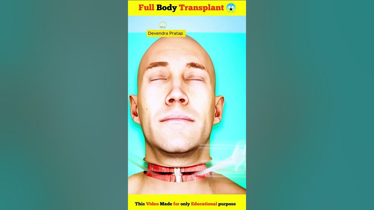 Full Body Transplant ( explained )! 😱 #shorts #devendra_pratap