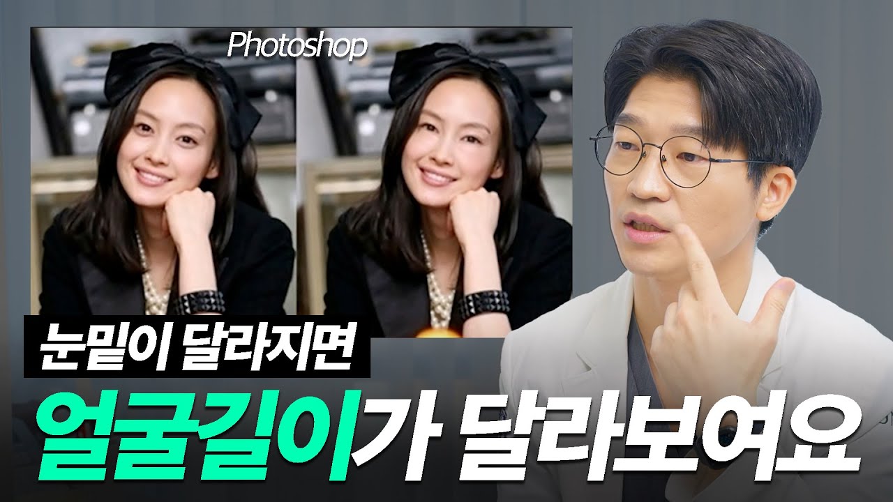 같은 얼굴인데 중안면부가 짧아 보이는 비밀 [중안면부 시리즈3편]