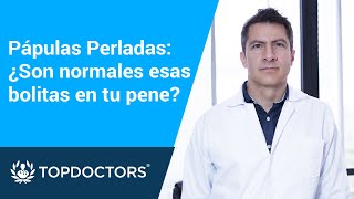 Pápulas perladas: ¿Son normales esas bolitas en tu pene? by Top Doctors LATAM 127 views 1 day ago 3 minutes, 24 seconds