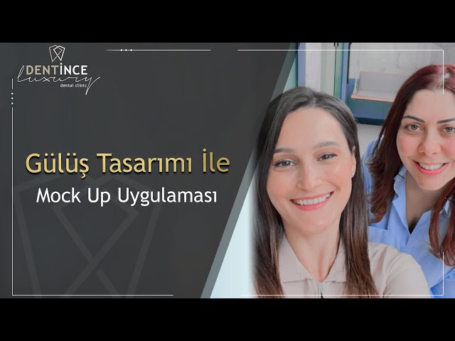 Gülüş Tasarımı İle Mock up Uygulaması