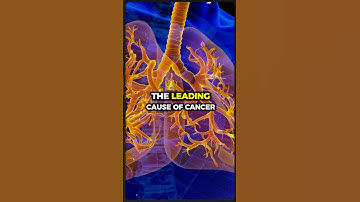 The Biomarkers Revolutionizing Lung Cancer Treatment