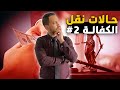 حالات نقل الكفالة (2)