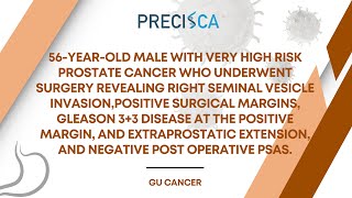 Expert Cancer Panel: High-risk prostate ca w/ positive margin at seminal vesicle and negative PSAs