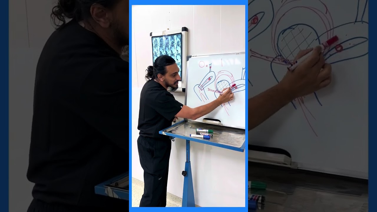 ما الذي يمكن ان تفعله الاورام الليفيه وأحدث طرق العلاج #د_البنا_مصر