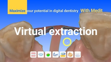 First step for immediate restoration : Virtual extraction