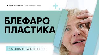 БЛЕФАРОПЛАСТИКА — РЕАБИЛИТАЦИЯ, ВОЗМОЖНЫЕ ОСЛОЖНЕНИЯ