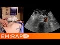 Ultrasound of Abdominal Aortic Aneurysm (AAA)