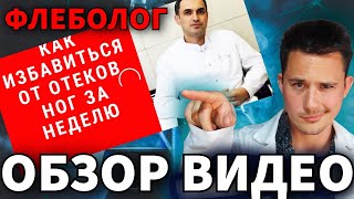 Как избавиться от отёков ног ЗА НЕДЕЛЮ | РЕЦЕПТ от отеков | Лечение отеков ног | Почему отекают ноги