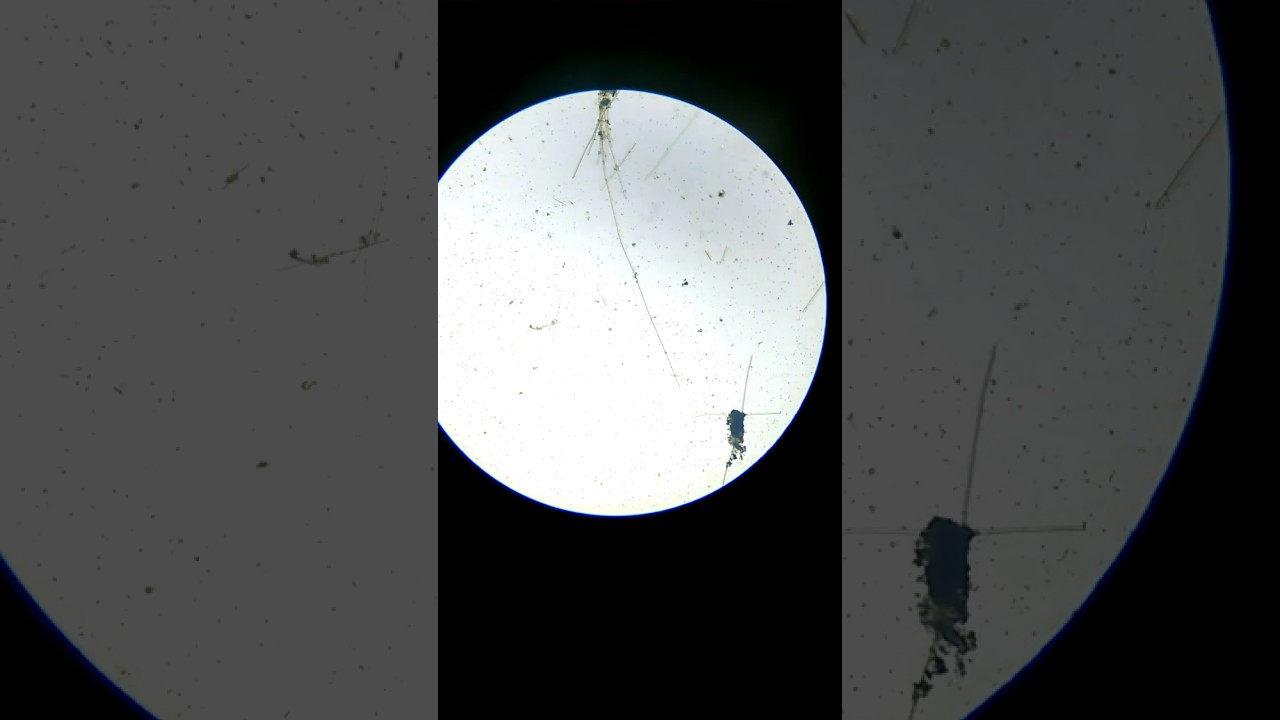 Agua De Charco En El Microscopio - MXEDUSA