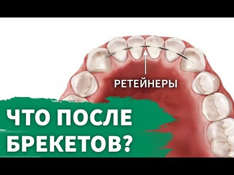 Ретенционный период  Что это и как долго длится?