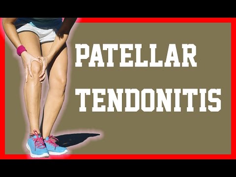 patellar-tendonitis-ultrasound-iontophoresis---patellar-tendonitis---neobracex