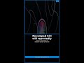 #Shorts Revamped Siri will reportedly offer auto-deleting