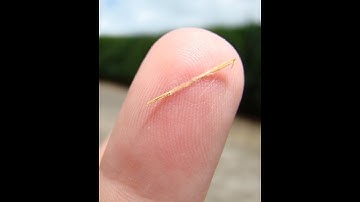 Removal of Foreign Body Scrotum CPT code - simplify medical coding