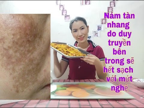 Vĩnh biệt NÁM TÀN NHANG bên trong sẻ hết sạch với  mứt nghệ dễ làm tại nhà