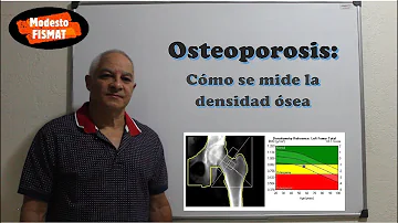 ¿Cuál debe ser la densidad ósea de una mujer?