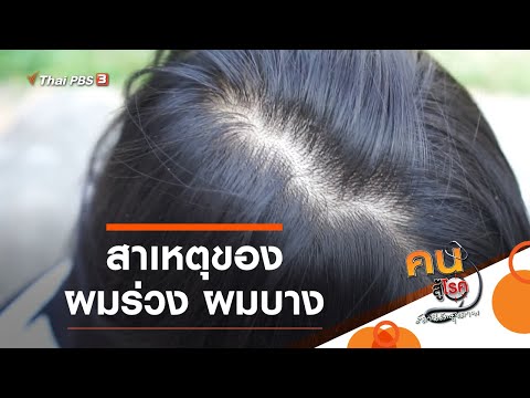 วีดีโอ: คุณสามารถย้อนกลับผมหงอก? สาเหตุที่เป็นไปได้และการเยียวยาธรรมชาติที่ต้องลอง