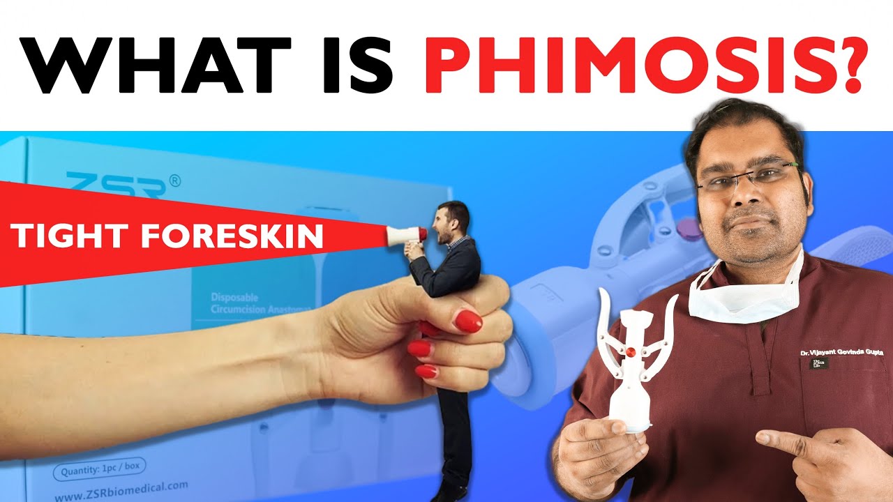 What Is Phimosis Tight Foreskin And Treatment Remastered In English Youtube