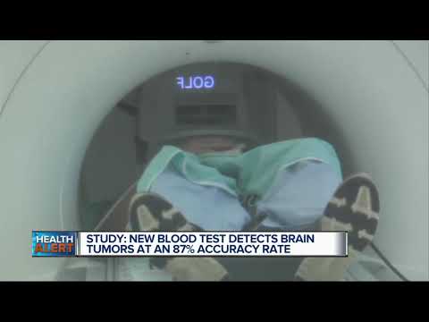 Videó: Megmutatnak agydaganatok a vérvizsgálaton?