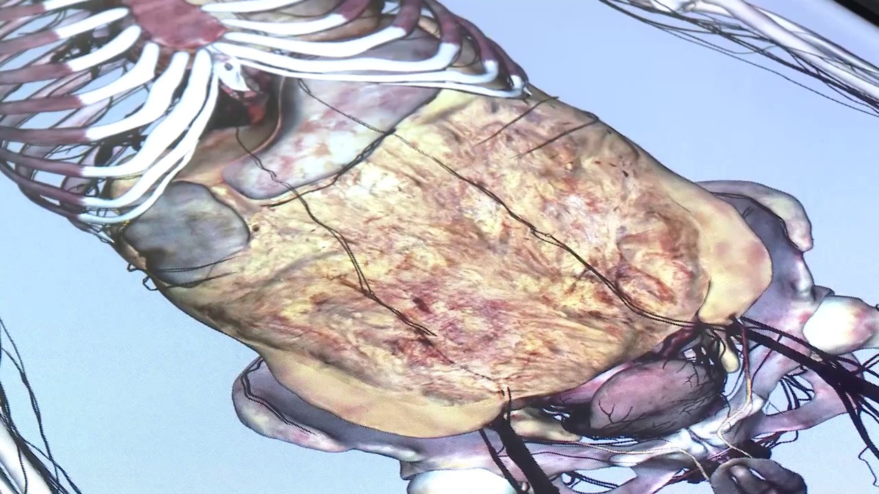 The Digestive System - YouTube