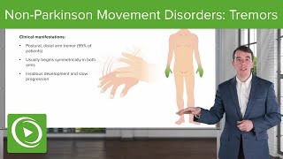 Non-parkinsonian Movement Disorders: Tremors | Lecturio Medical