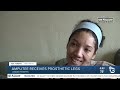 Logan Heights mom stands on prosthetic legs after flesh-eating disease battle