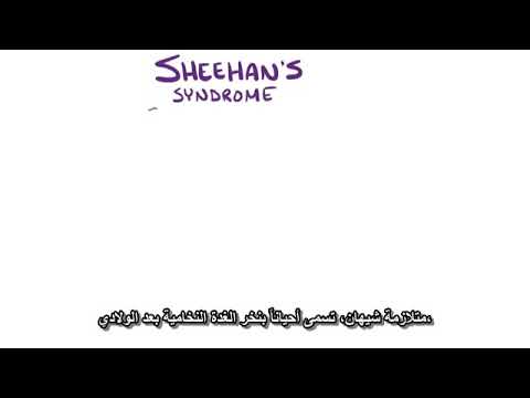 متلازمة شيهان