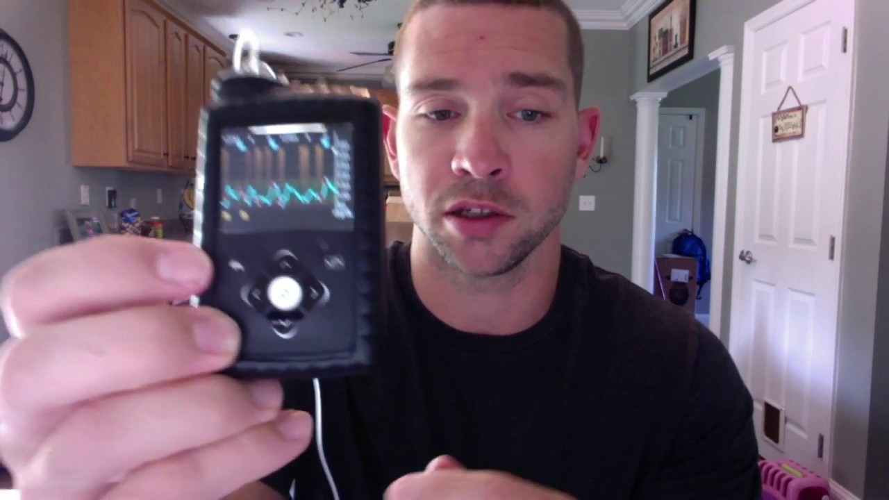 Medtronic 670g Review In Manual Mode - YouTube