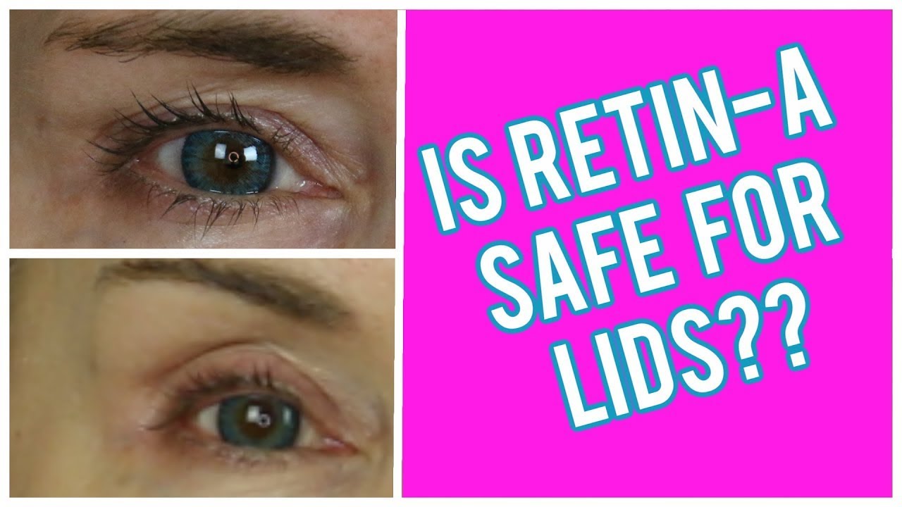 HOW TO USE RETIN-A FOR HOODED EYELIDS | HOW I APPLY IT | ASK YOUR DOCTOR IF this might WORK FOR YOU