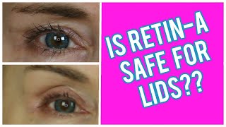 HOW TO USE RETIN-A FOR HOODED EYELIDS | HOW I APPLY IT | ASK YOUR DOCTOR IF this might WORK FOR YOU
