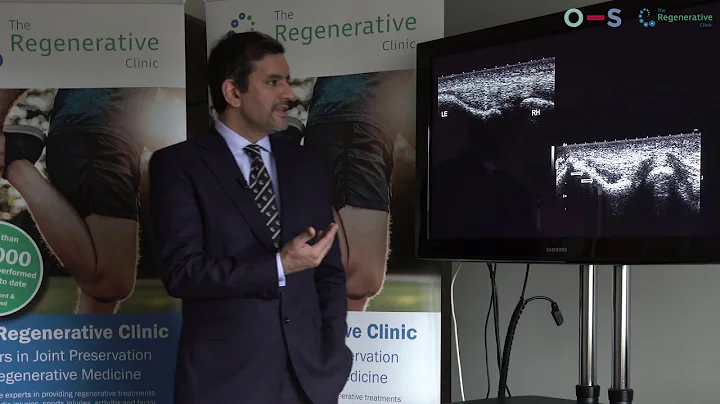 Orthopaedic surgeon Mr. Ali Noorani: the treatment of tennis elbow using injections