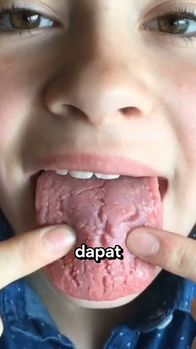 Berhenti Makan Lemon‼️😱