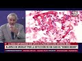 ¿Qué es el "hongo negro"? El extraño caso en Uruguay que enciende las alarmas