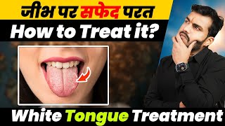 जीभ पर सफेद परत-White Tongue Why It Happens and How to Treat It- Dr Arun Mishra |Ep.539