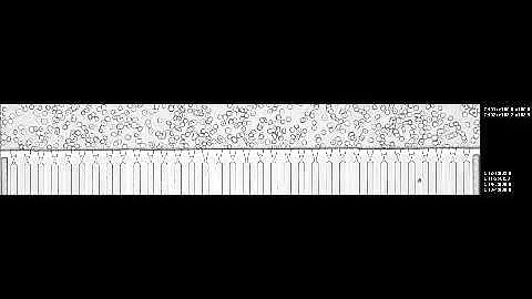 Multiplexed Fluidic Plunger Mechanism for the Measurement of Red Blood Cell Deformability