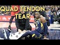 Doctor Reviews Victor Oladipo Injury | Quad Tendon Rupture