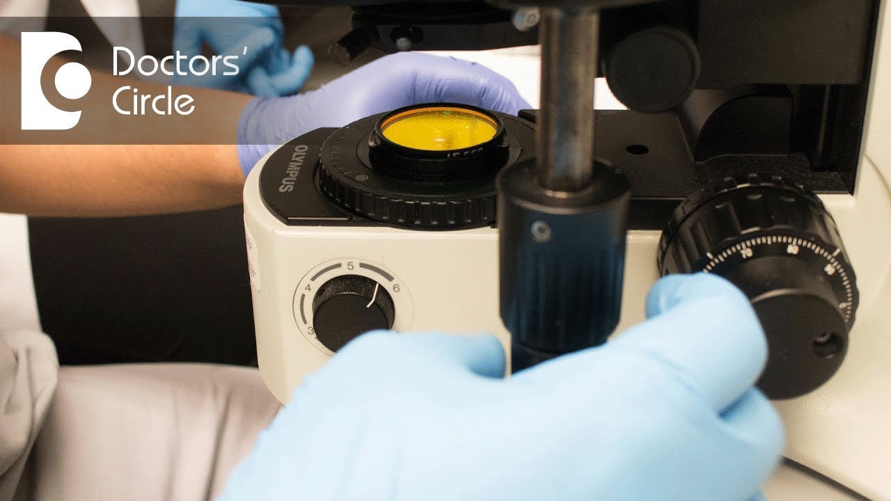 Is conception possible if semen analysis shows low sperm motility? - Dr. Shefali Tyagi Is conception possible if semen analysis shows low sperm motility ...