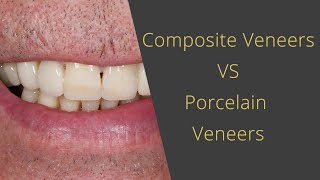 Composite Teeth Veneers Vs. Porcelain Veneers