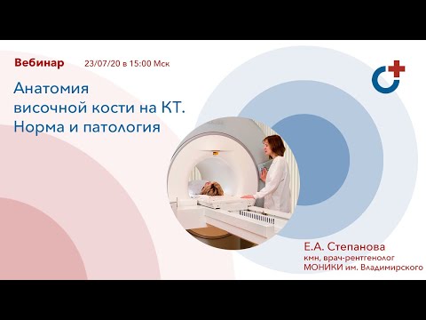 Анатомия височной кости на КТ. Норма и патология.