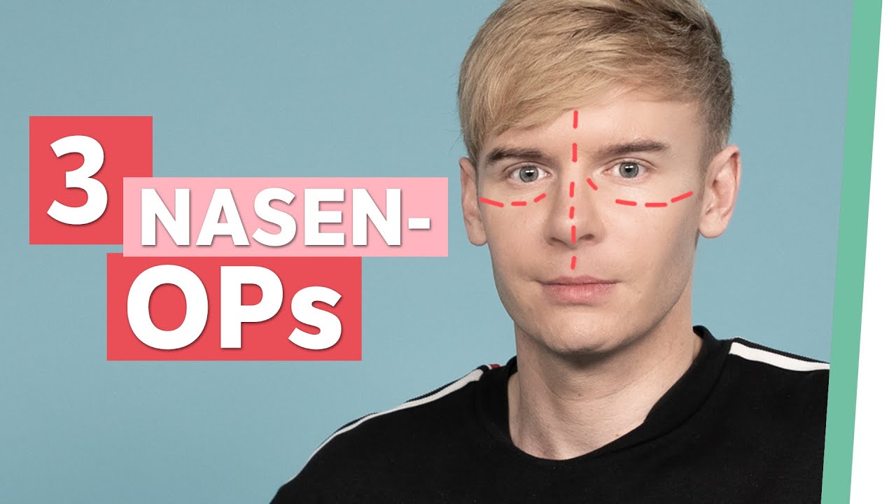 Schonheits Op Ich Bereue Die Entscheidung Auf Klo Youtube