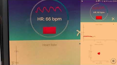 HRV Camera Usage